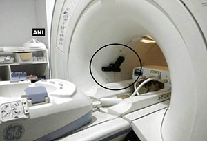 MRI Accident